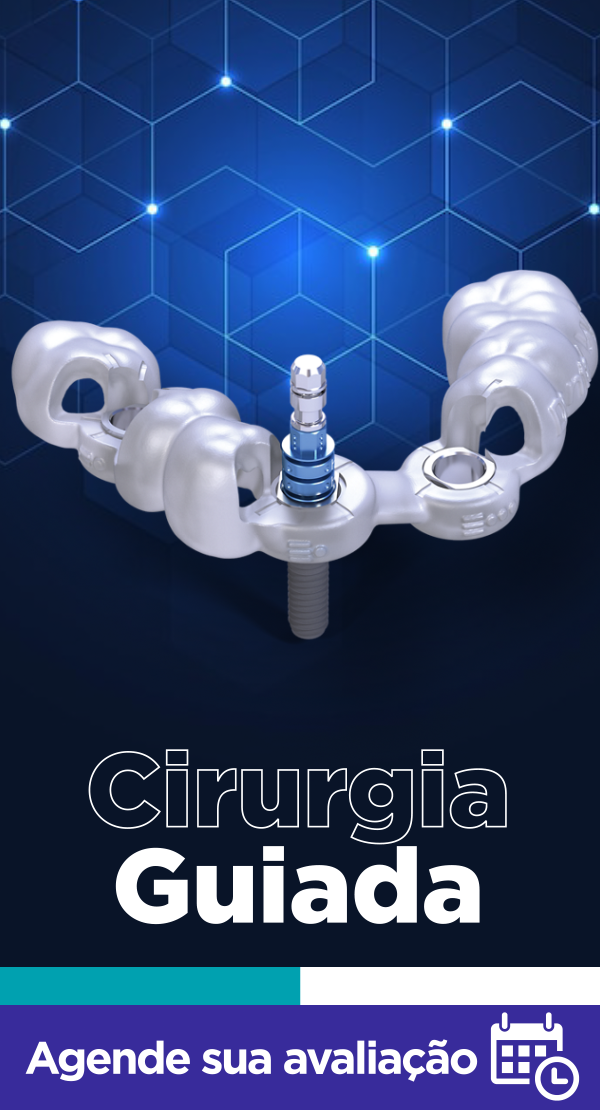 Cirurgia de Implantes Dentários sem cortes e sem pontos!