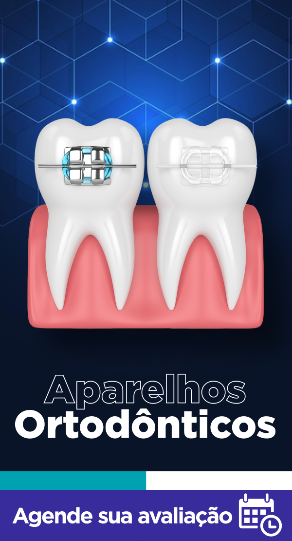 Correção e posicionamento dos dentes de forma correta melhorando a sáude bucal do paciente!